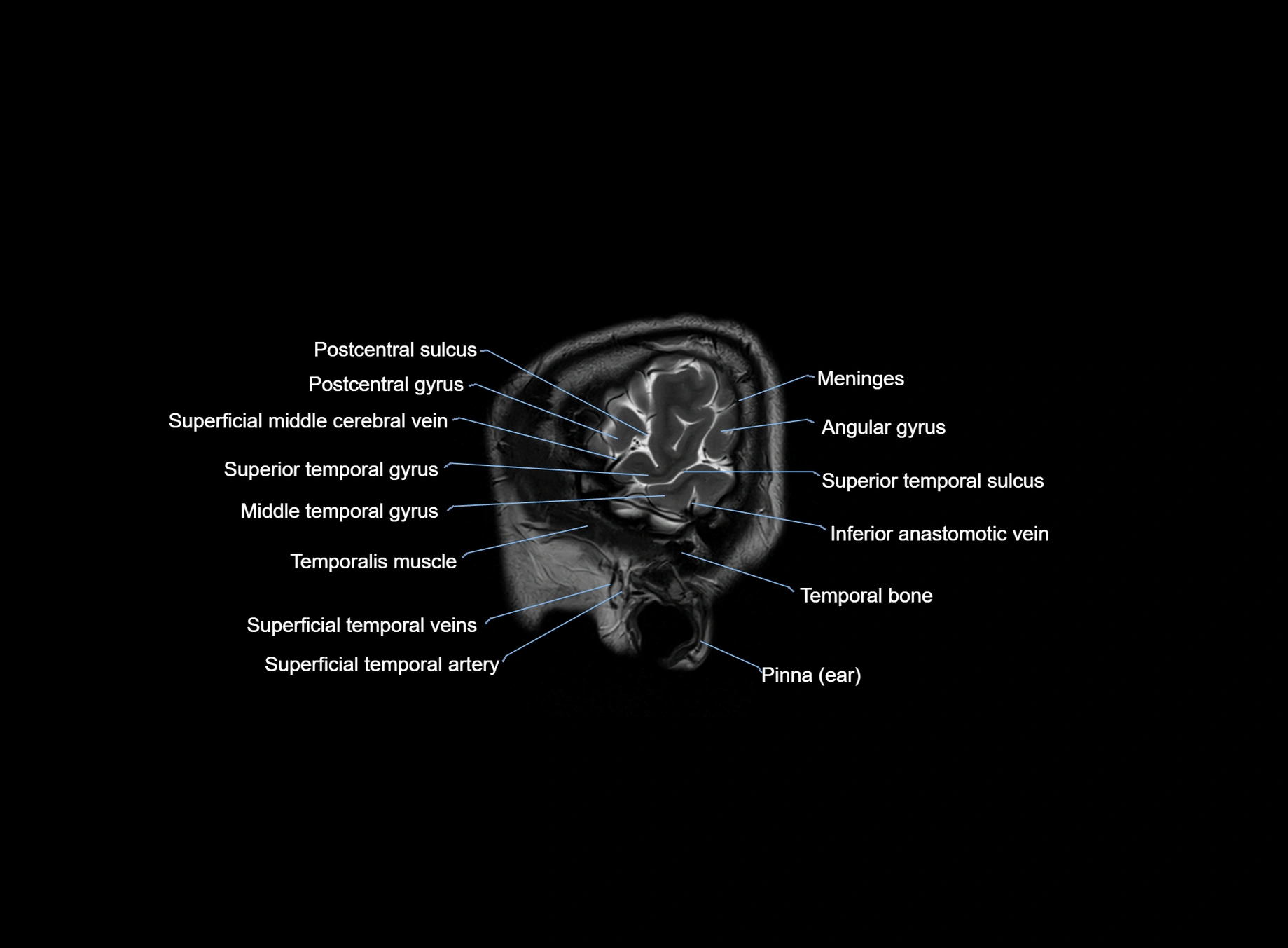 brain sagittal anatomy 3T MRI images -img-00001-00005.webp
